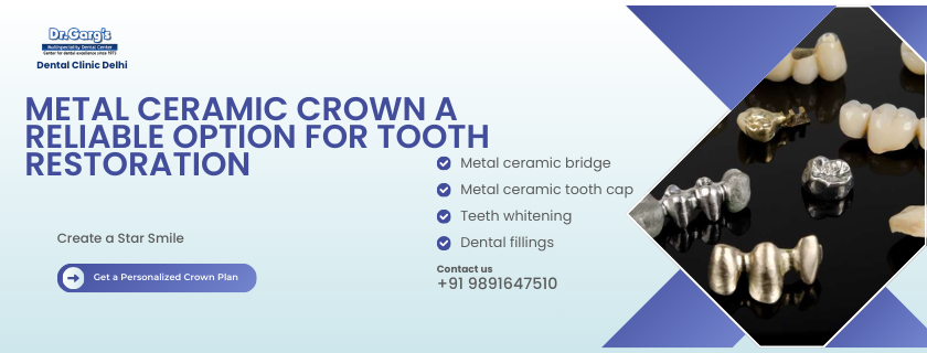 Metal Ceramic Crown A Reliable Option for Tooth Restoration