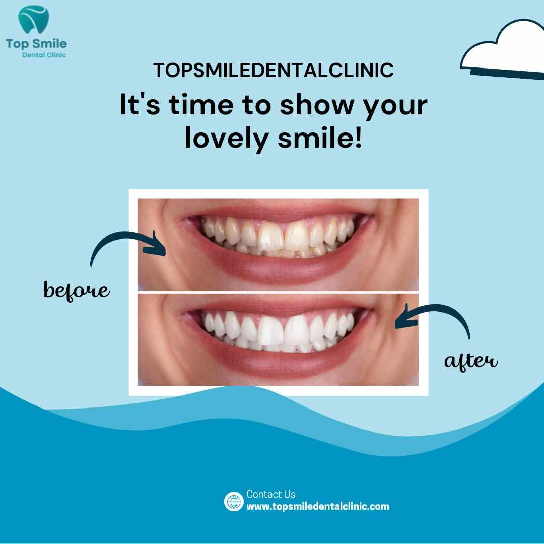 Nearest Dental Clinic – How to Find the Right One for Your Smile