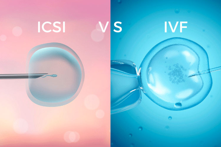IVF vs. ICSI: Which Treatment Is Right for You?