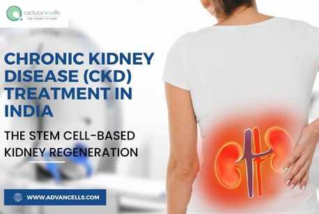 CKD Treatment in India: The Stem Cell-Based Kidney Regeneration