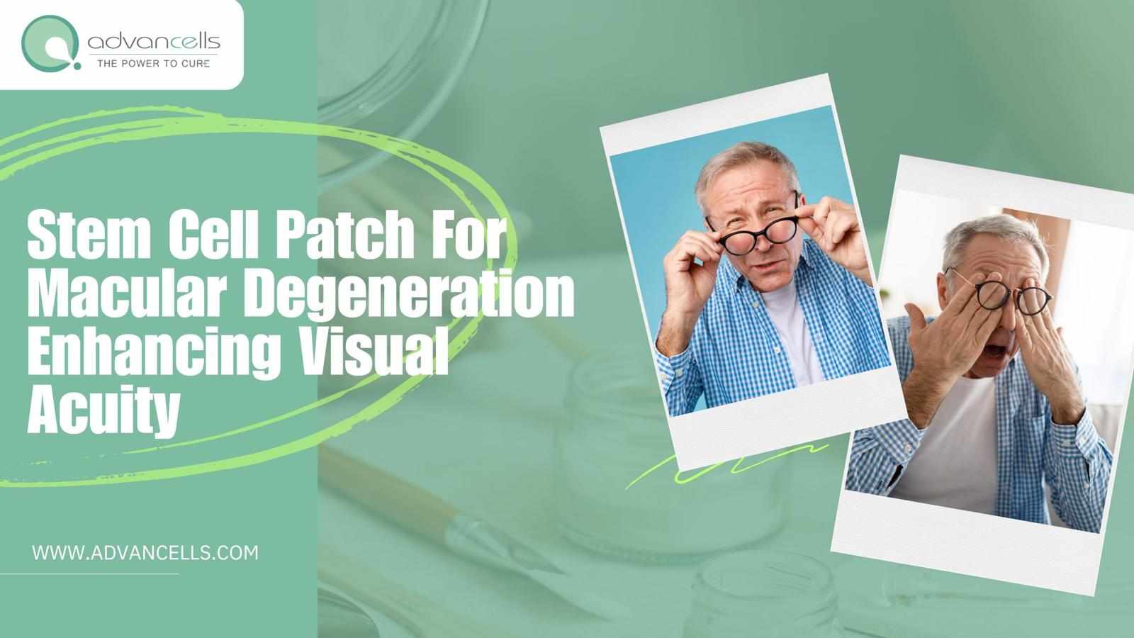 Stem Cell Patch For Macular Degeneration: Enhancing Visual Acuity