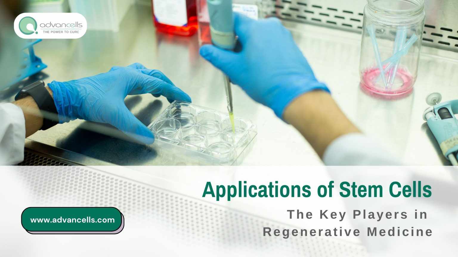Applications of Stem Cells: The Key Players in Regenerative Medicine