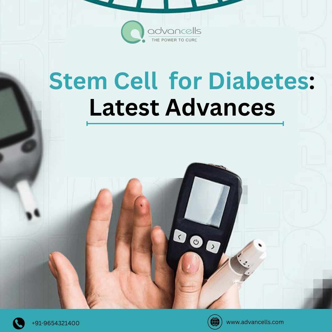 Stem Cell for Diabetes: Latest Advances