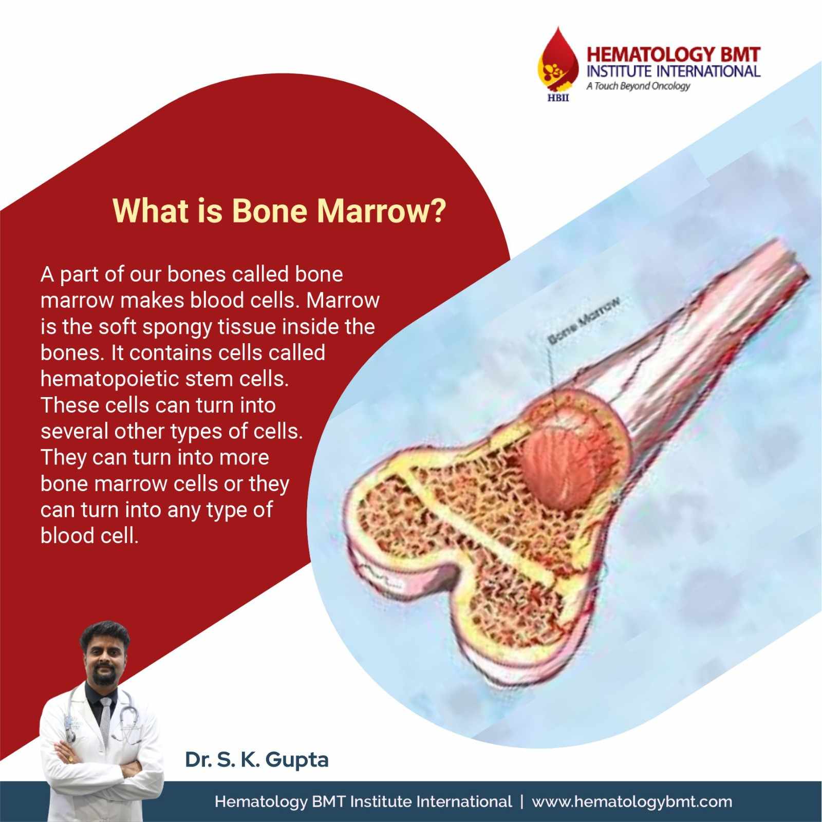 Bone marrow transplant in Hyderabad—Dr. SK Gupta
