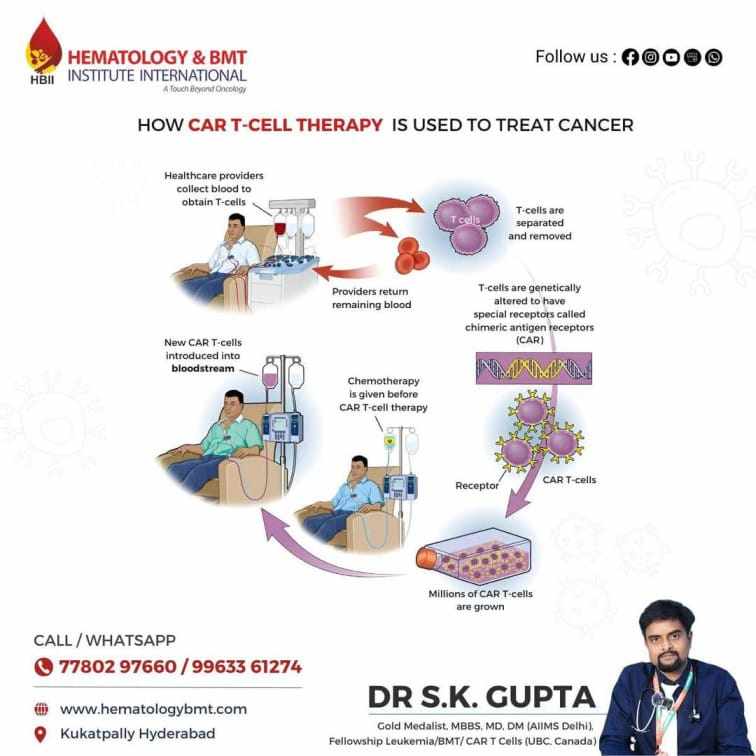 CAR T Cell Therapy in Hyderabad: Expert Care by Dr. S.K. Gupta