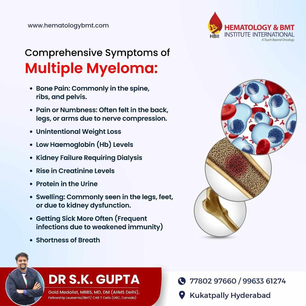 Multiple Myeloma – Advanced Treatment by Dr. S K Guptha