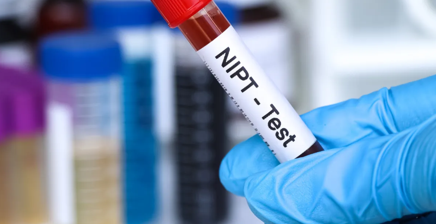 Why the NIPT Test Is the Top Choice for Prenatal Screening