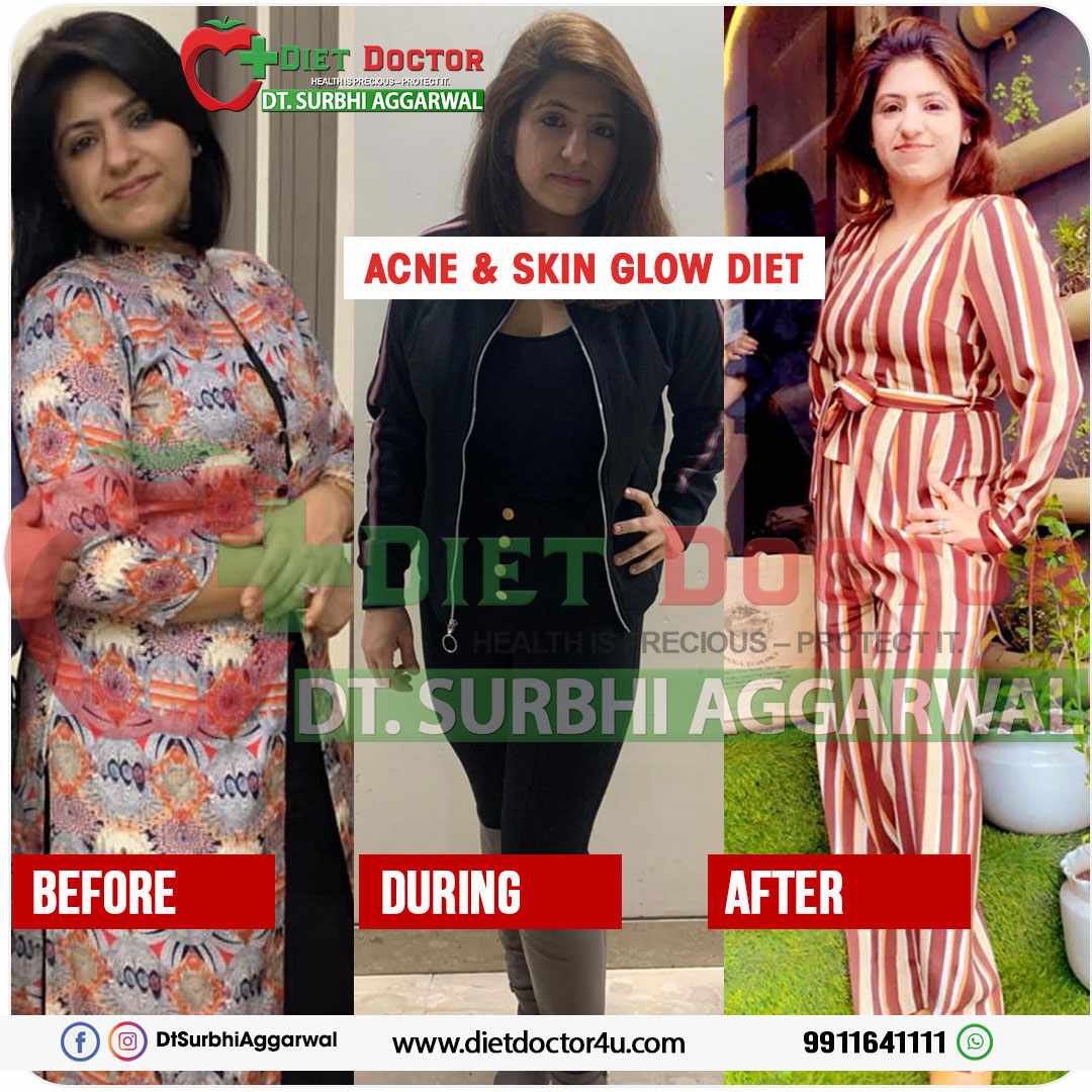 Top Dietitian in Paschim Vihar | Dietician Surbhi