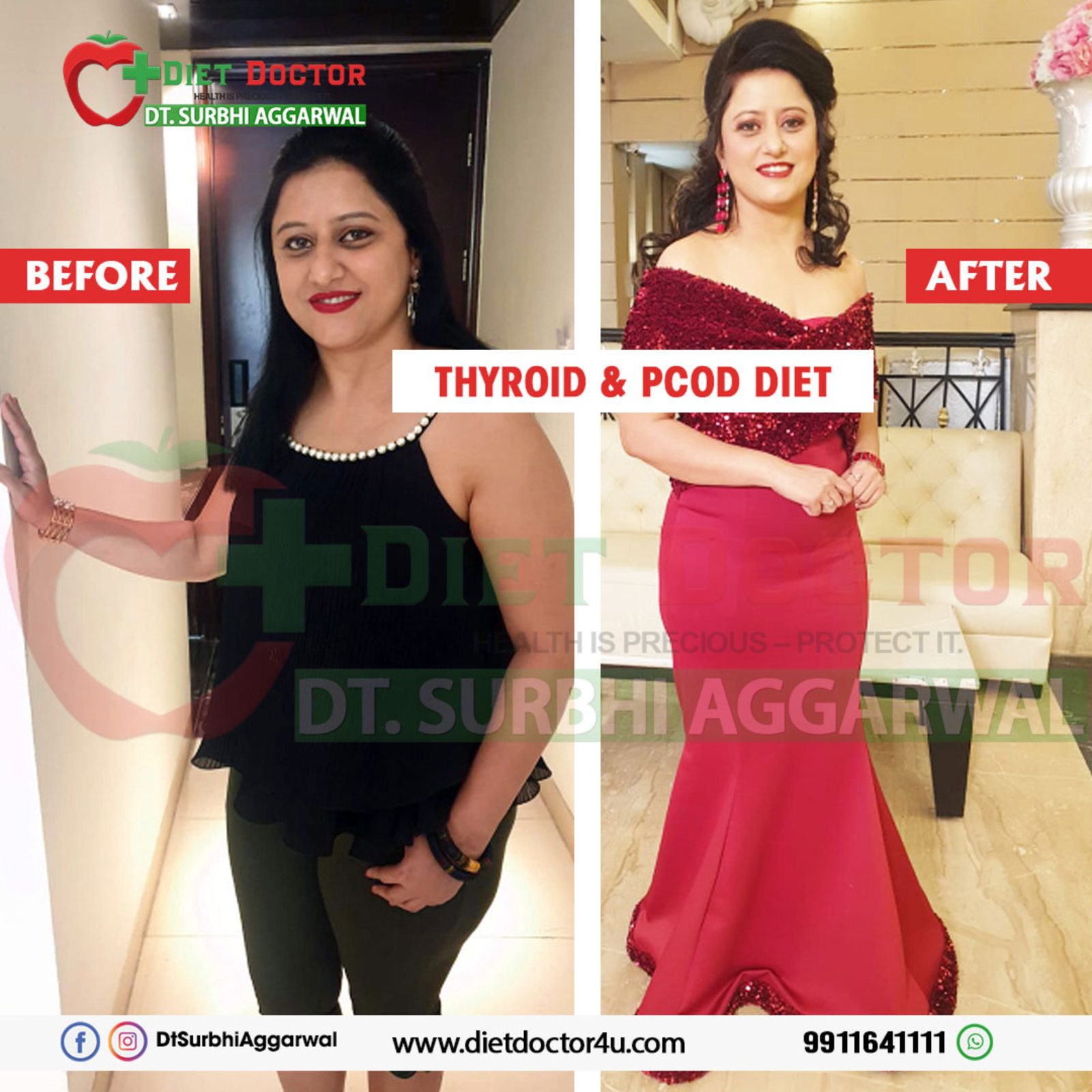 Top Dietitian in Punjabi Bagh | Dietician Surbhi