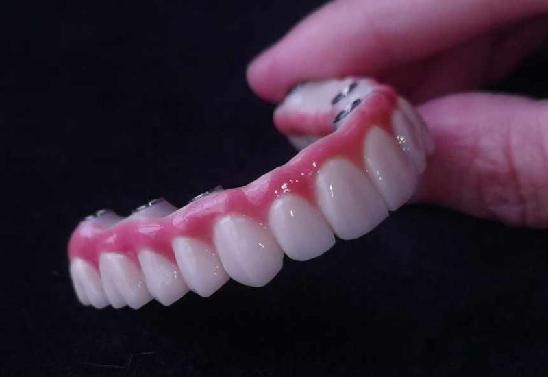 Why should one select a digital dental lab?