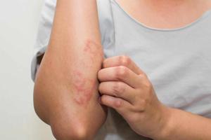 Asthma and Allergies: When to Consult an Allergy Doctor in Dubai