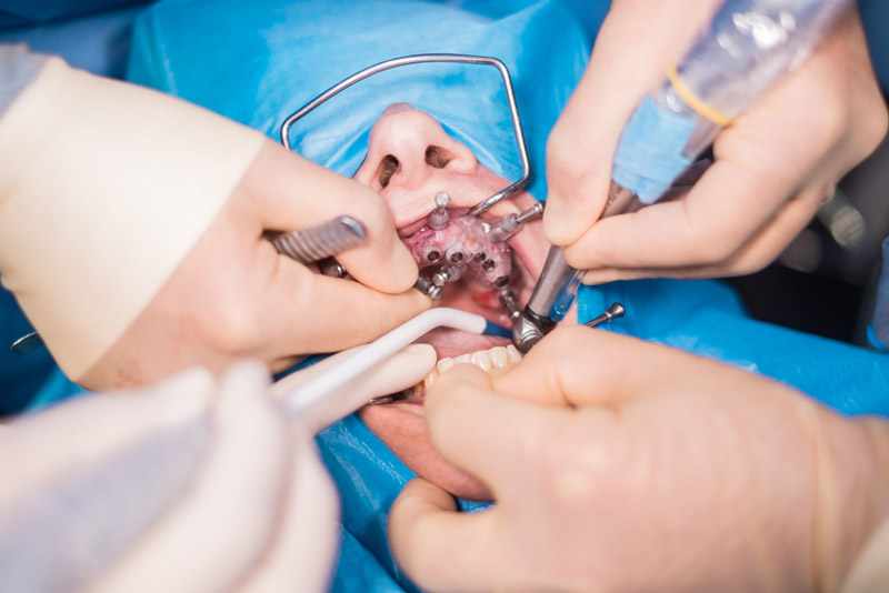 Facial Trauma Care: How an Oral and Maxillofacial Surgeon in Dubai Can Help