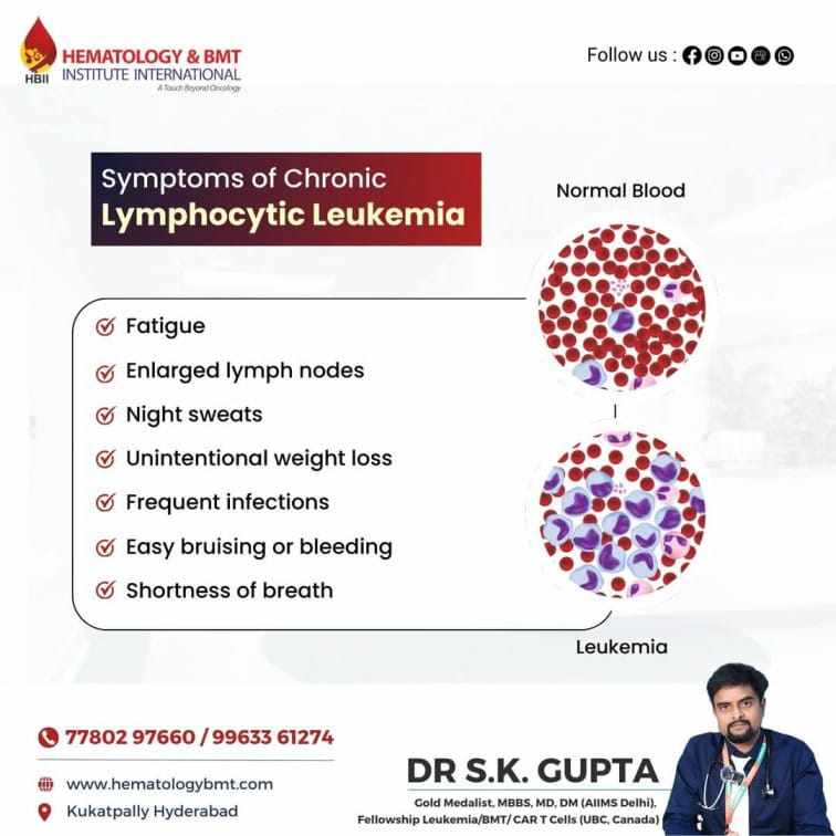 Expert Care for Leukemia: Dr. S.K. Gupta, Renowned Leukemia Specialist