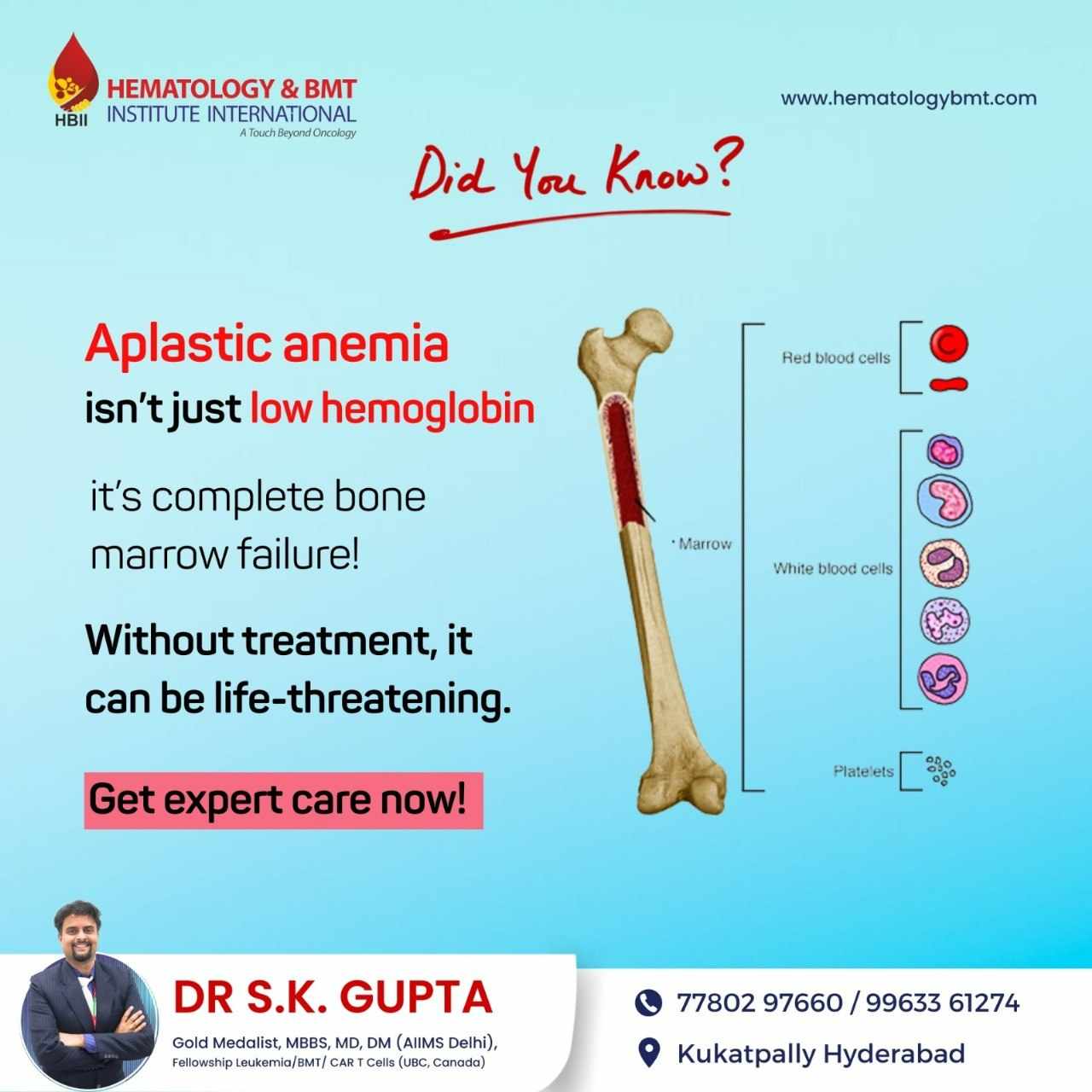 Best Aplastic Anemia Treatment: Expert Care by Dr. S.K. Gupta