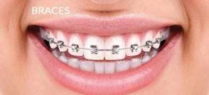 Invisalign Bahrain | Aesthetica Dr. Reem AlShaiba Dental Center