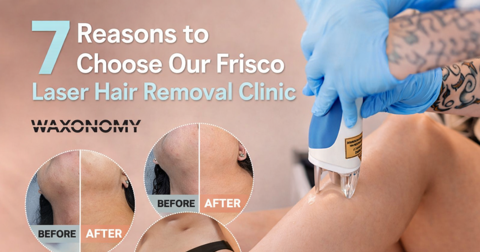 SplendorX is transforming laser hair removal in Frisco in 7 ways.