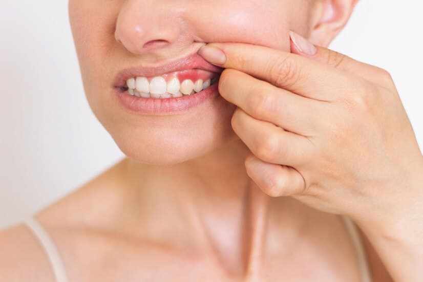 Top Gum Specialists Near Me: How to Find the Right One