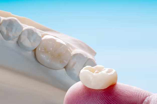 The Different Types of Tooth Bridges Explained