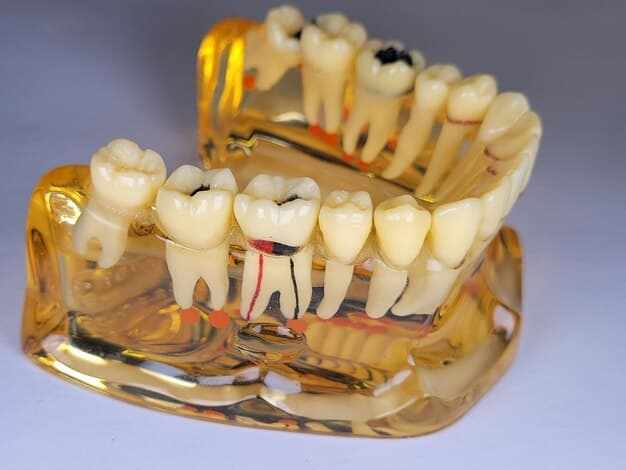 Step by Step Guide to Getting Dental Bridges in Oxnard