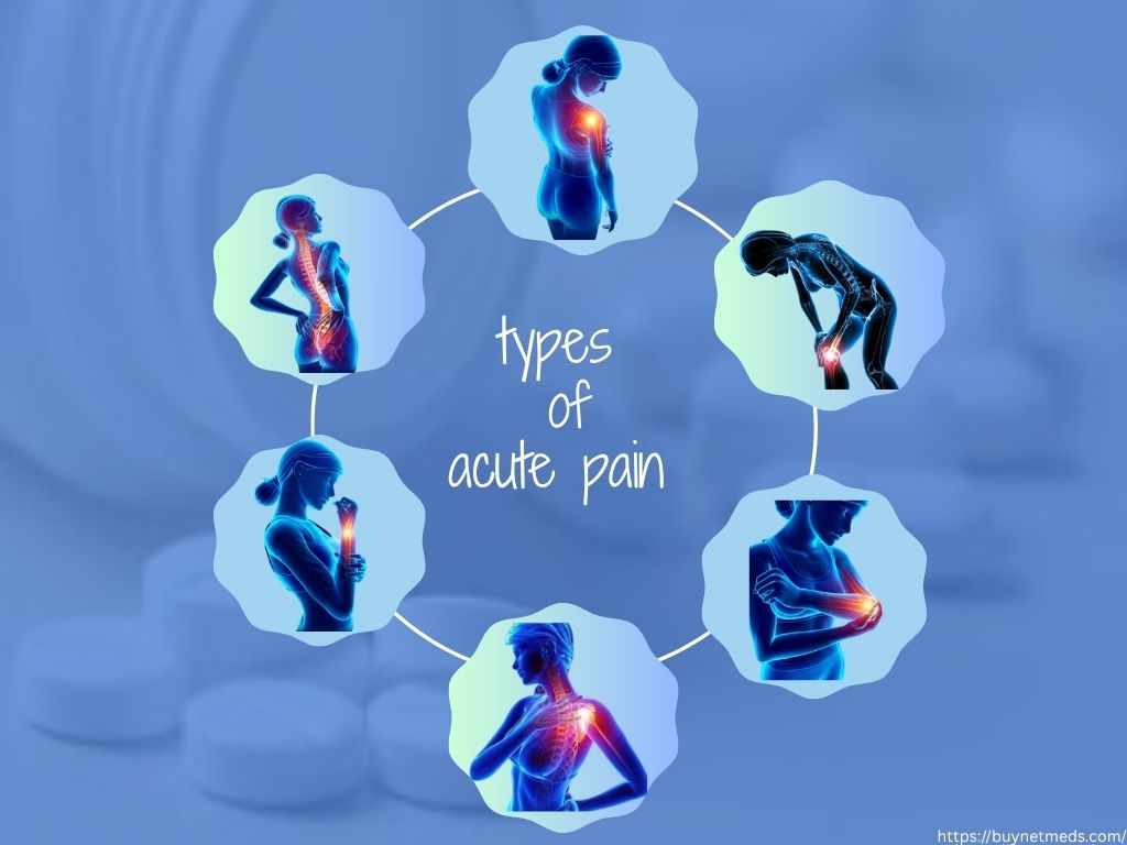 Pain-O-Soma 500mg – Quick Comfort for Muscle Pain