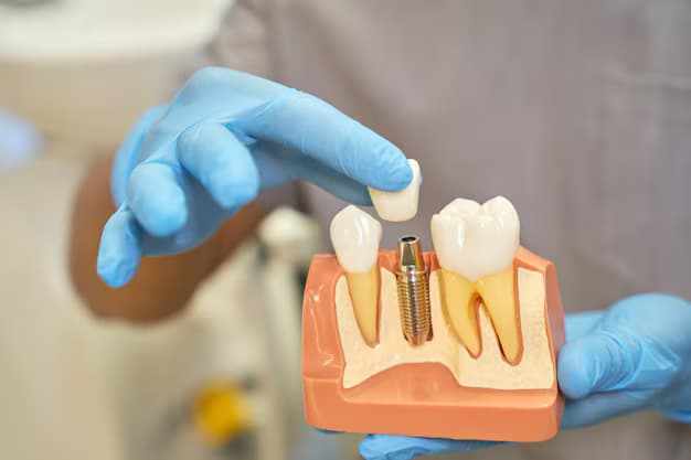Benefits of Choosing Dental Implants in Riverpark