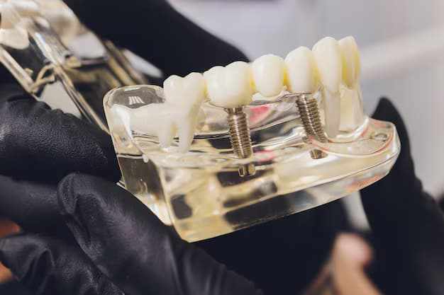 Implants Near Me: How to Find the Best Implant Dentist