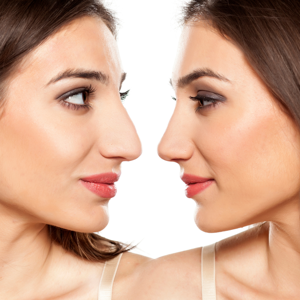 Mommy Makeover Insights from a Plastic Surgeon Lakeland Florida