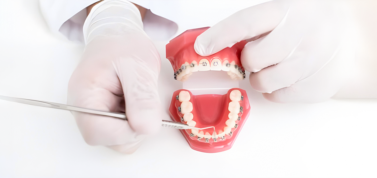 Top Cosmetic Dentistry Options to Fix Teeth Gaps Without Braces in Delhi & Gurgaon