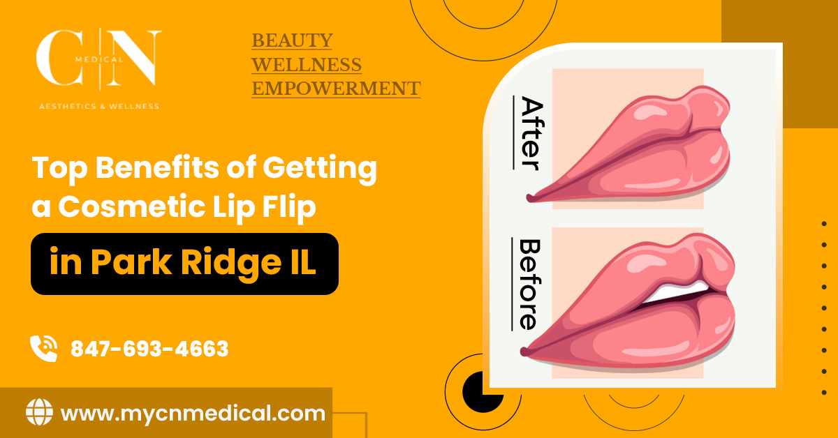 Top Benefits of Getting a Cosmetic Lip Flip in Park Ridge IL