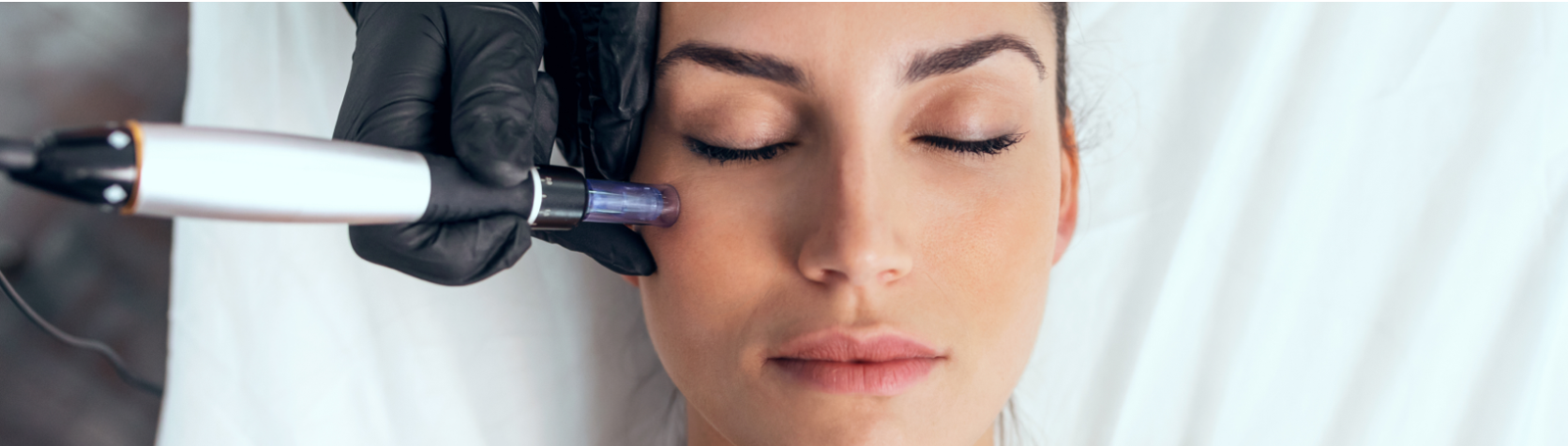 Microneedling in Brisbane: Top Things to Know Before Your First Session