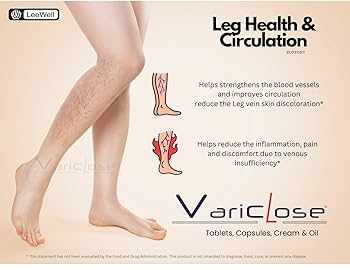 Venoxil Varicose France Preventing blood pooling in the legs