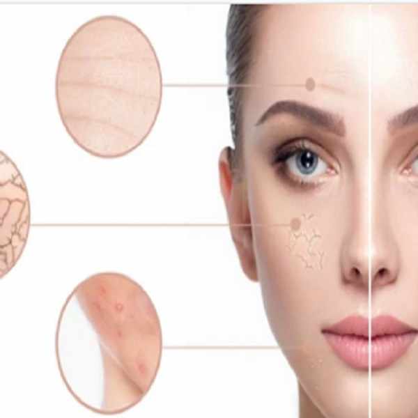 Collagen Induction Therapy: Why Your Skin Needs This Boost