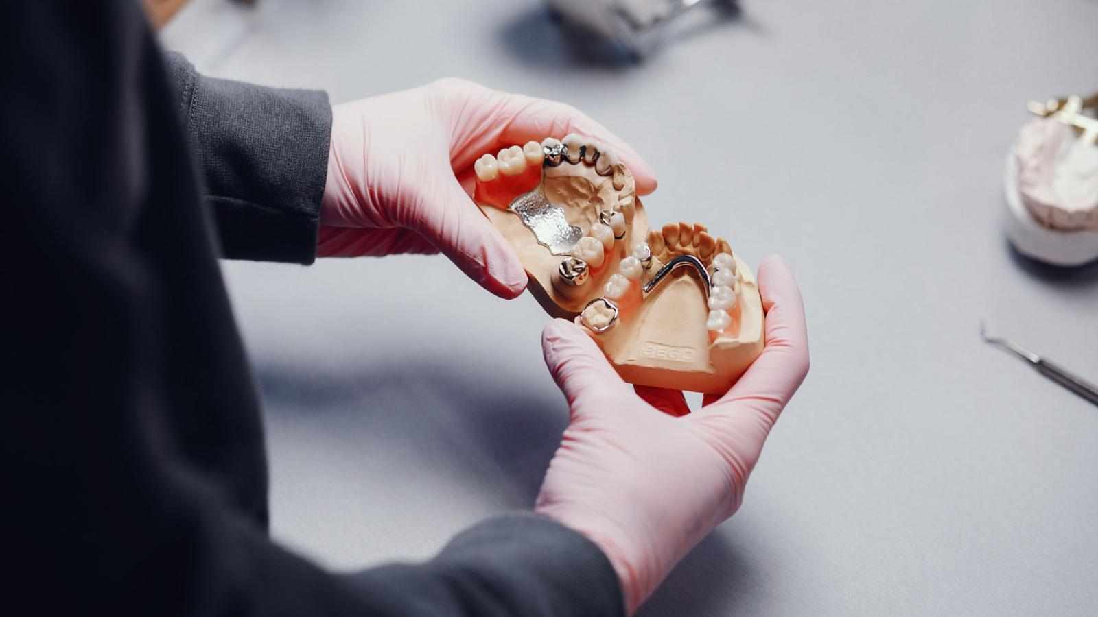 What Is a Partial Cobalt Chrome Denture and Is It Right for You?