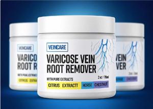 Veincarevariceveinrootremoveros
