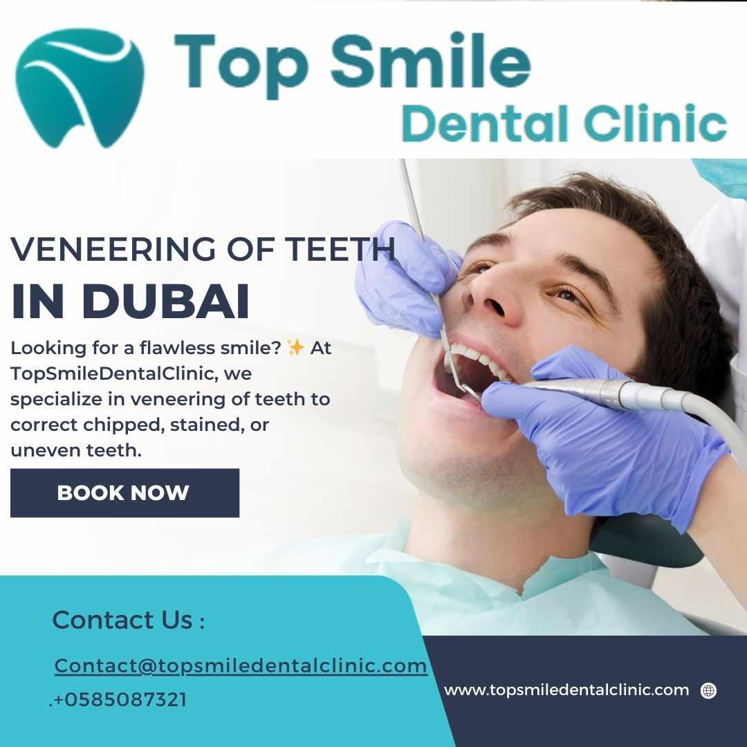 Veneering of Teeth in Dubai – Transform Your Smile at TopSmileDentalClinic