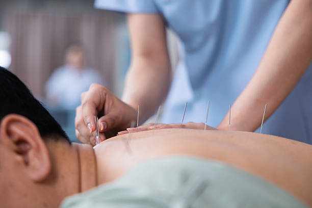 Acupuncture for Stress Relief: Natural Healing and Lasting Relaxation