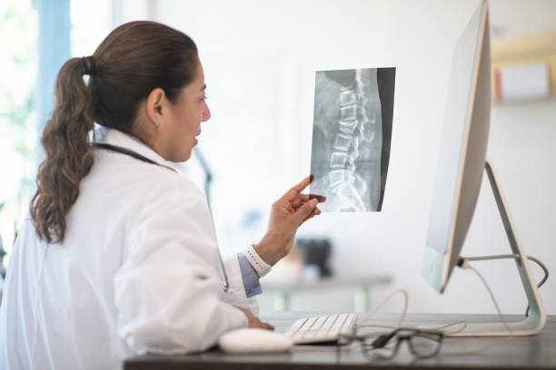 A Doctor Reviewing X-ray Results stock photo A Doctor reviewing her patients x-ray results for possibly breaks, fractures and abnormalities spine Clinic stock pictures, royalty-free photos & images