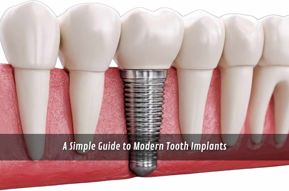 A Simple Guide to Modern Tooth Implants