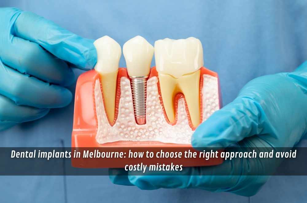 Dental implants in Melbourne: how to choose the right approach and avoid costly mistakes