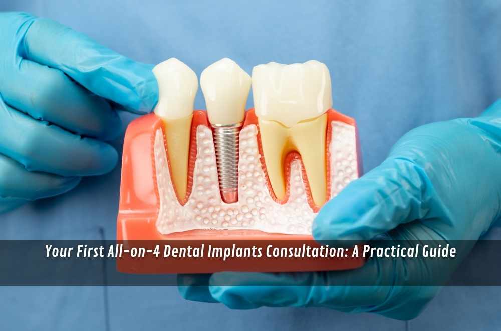 Your First All-on-4 Dental Implants Consultation: A Practical Guide
