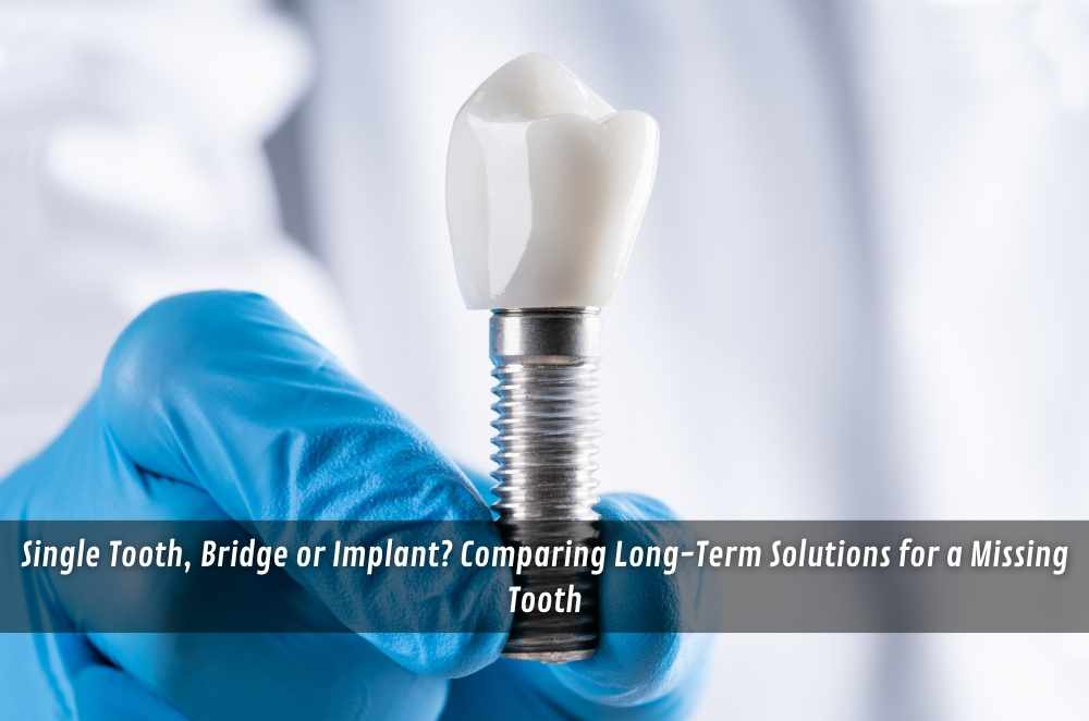 Single Tooth, Bridge or Implant? Comparing Long-Term Solutions for a Missing Tooth