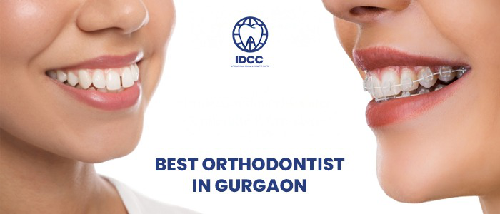 How do I book an appointment with the best Invisalign specialist in Gurgaon?