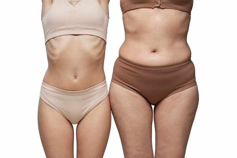What to Expect Before and After the Liposuction Procedure
