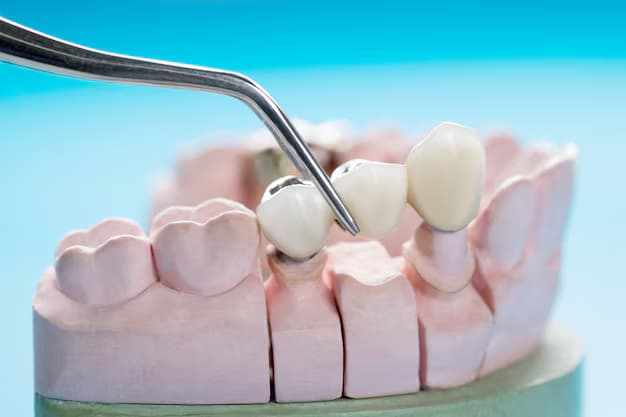How Tooth Bridges Restore Function and Appearance