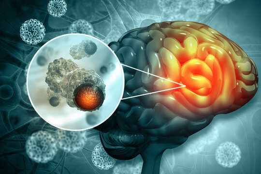 Pediatric Brain Tumors Market: Size, Trends, and Strategic Insights 2025-2032