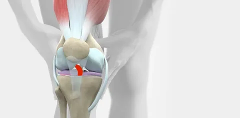 Anterior Cruciate Ligament Injuries Market: Size, Trends, and Growth Analysis 2025-2032