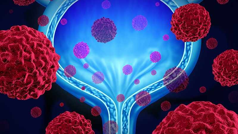 Rapid Expansion in Testicular Cancer Drugs Market: Size, Analysis & Trends