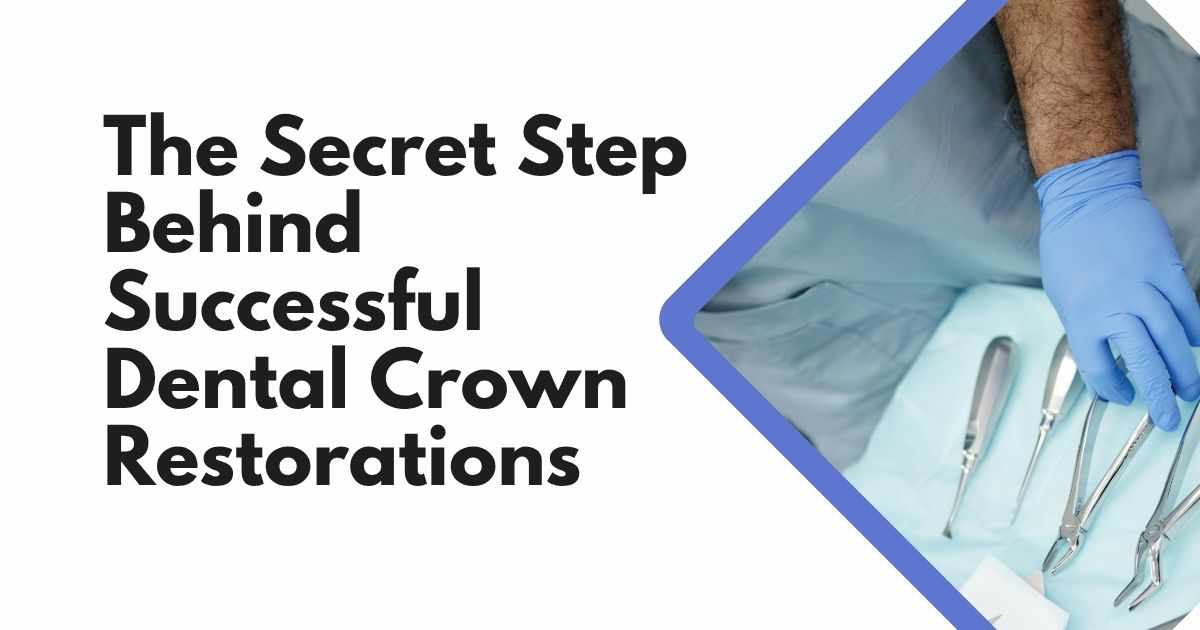 The Secret Step Behind Successful Dental Crown Restorations