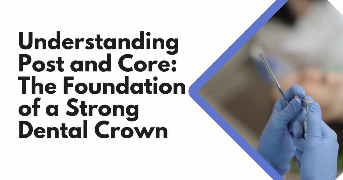 Understanding Post and Core: The Foundation of a Strong Dental Crown