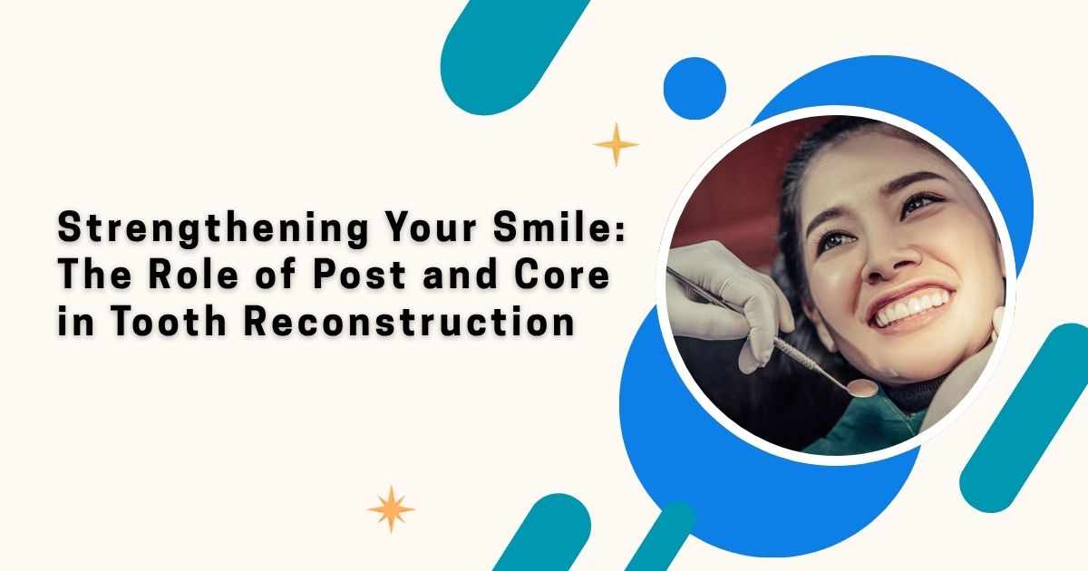 Strengthening Your Smile: The Role of Post and Core in Tooth Reconstruction